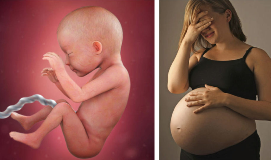 Por estas cosas una embarazada nunca debe tener peleas – Muy importante saber