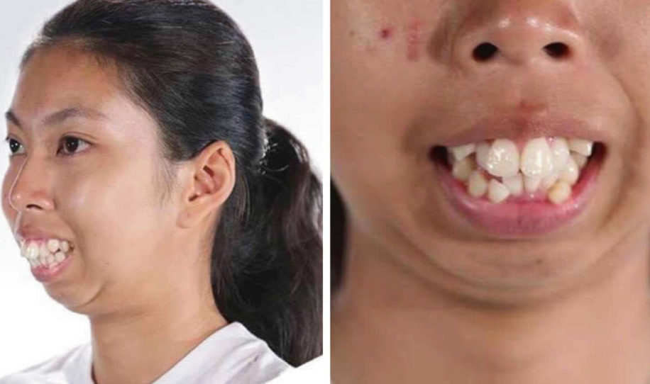 Esta mujer ganó una cirugía facial en un reality show y quedó irreconocible