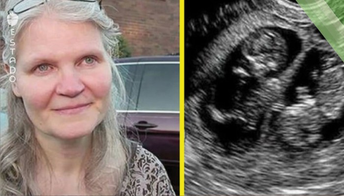 A los 41 años quedó embarazada de trillizos – lo que ven en el parto dejó hasta al doctor sin aliento