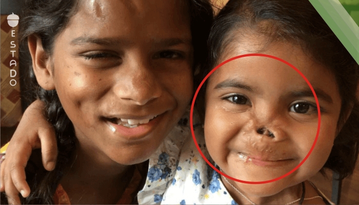 Una mujer adopta a niña india maltratada y 6 meses después a otra en peor estado
