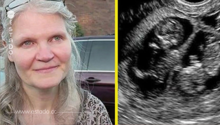 A los 41 años quedó embarazada de trillizos – lo que ven en el parto dejó hasta al doctor sin aliento