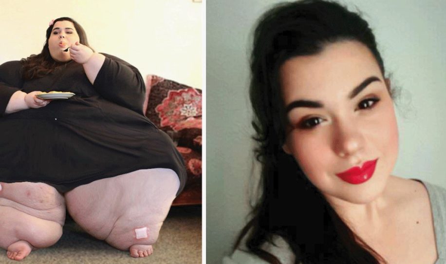 Mujer pesaba 298 kilos. Su increíble transformación después de perder 150 kg te dejará impactado.