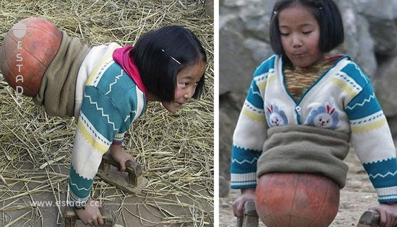 Mira como luce la ‘niña pelota’ después de 10 años – De niña fue abandonada pero hoy es millonaria