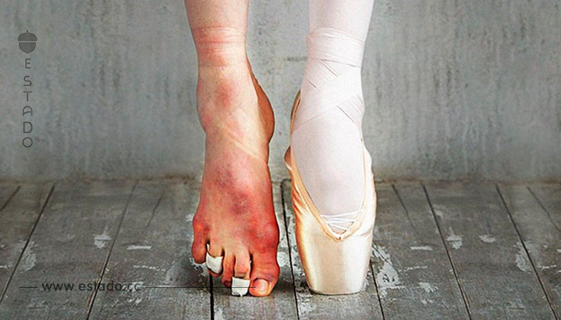 25 imágenes que ilustran el precio y el esfuerzo del ballet