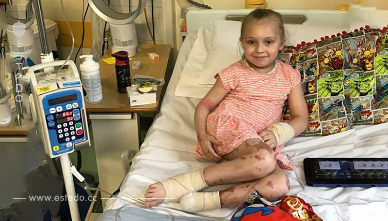 Los moretones no parecían graves: una niña de 7 años pierde un pie