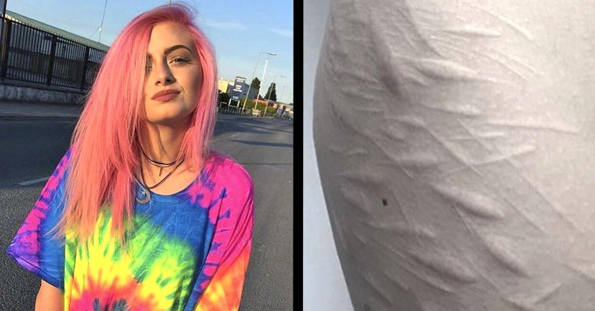 Tatuador ayuda a una chica de 19 años que se hirió a sí misma