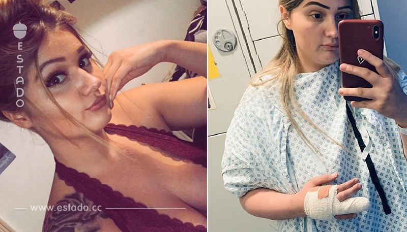 Mujer contrajo una infección por hacerse un manicure en un salón de belleza y casi le amputan un dedo