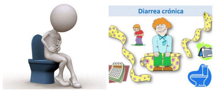 Diarrea: Síntomas, Causas Y Factores De Riesgo