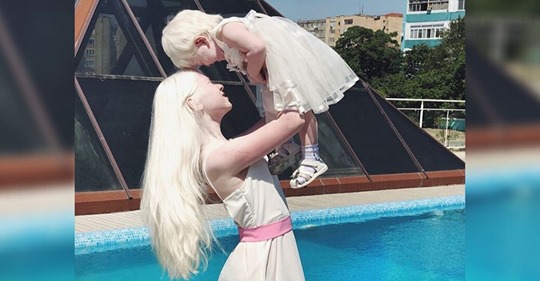 Asel y kamila, las hermanas albinas que le dan otro significado a la belleza