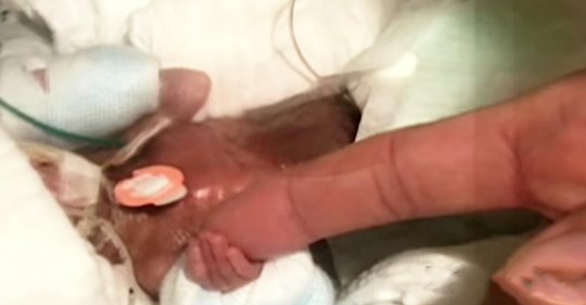 ¡El bebé más chiquito del mundo logró salir del hospital con buena salud