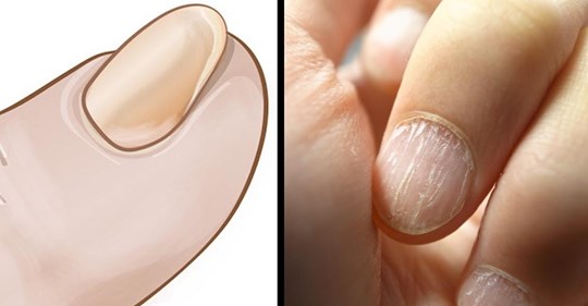 7 cambios alarmantes en las uñas
