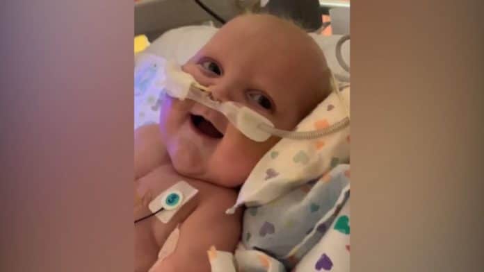 Bebé que ha tenido 2 operaciones a corazón abierto sonríe por primera vez
