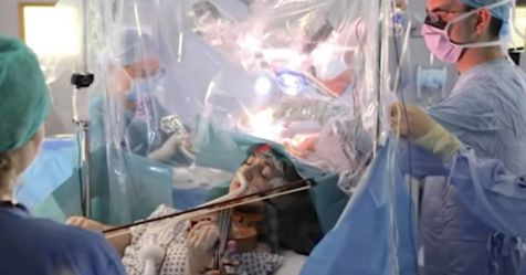Paciente toca el violín durante su propia cirugía cerebral para preservar su motricidad fina