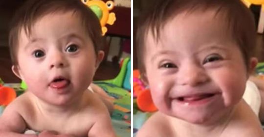 Una bebé con síndrome de Down ganó popularidad después de mostrarle a su madre adoptiva su 