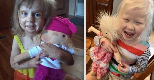 Mujer hace muñecos que se parecen a niños enfermos