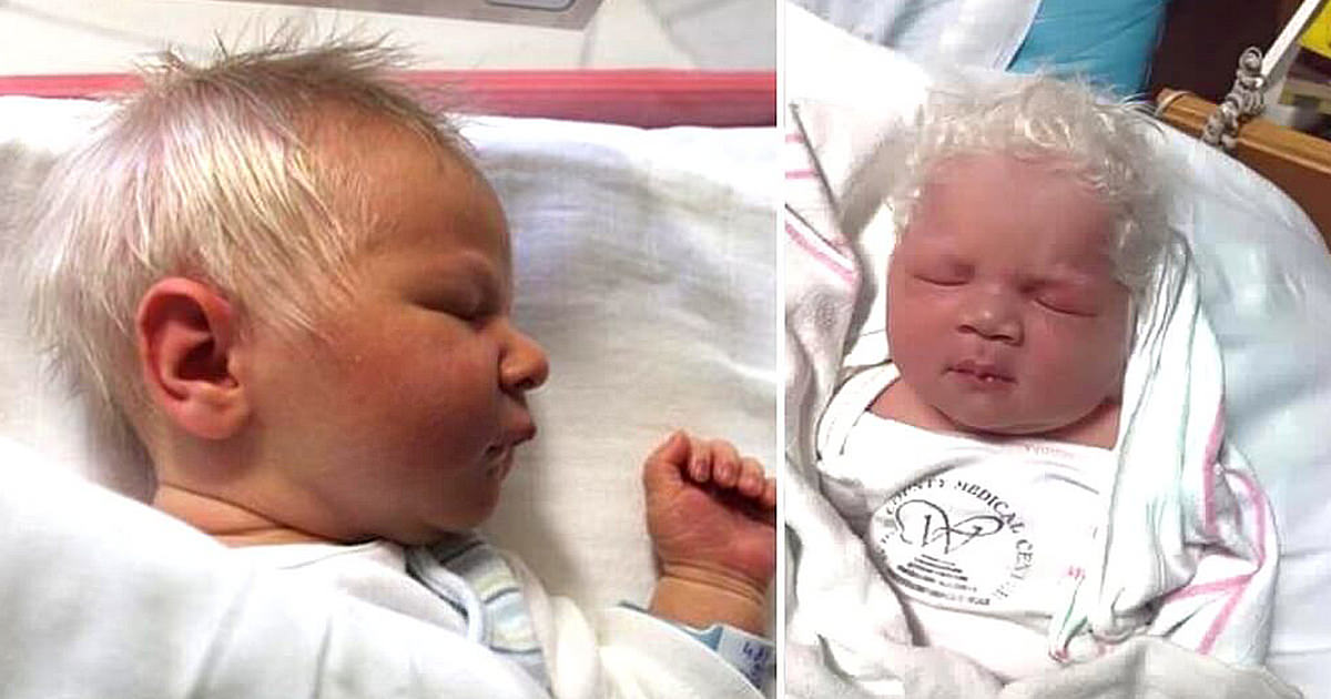 Niño nace con el pelo blanco y los médicos dicen que no es albino – incomprensible