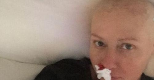 Shannen Doherty comparte las imágenes más duras de su lucha contra el cáncer
