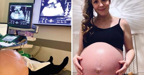 Su bebé murió en el vientre pero ella decidió seguir con el embarazo