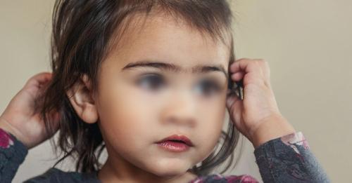 Depila uniceja a su niña de 5 años para evitar que la molestaran