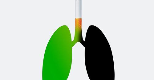 Cáncer de pulmón, las claves de un tumor altamente mortal pero prevenible