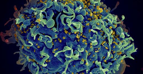 Científicos en EEUU logran curar a la primera mujer con VIH