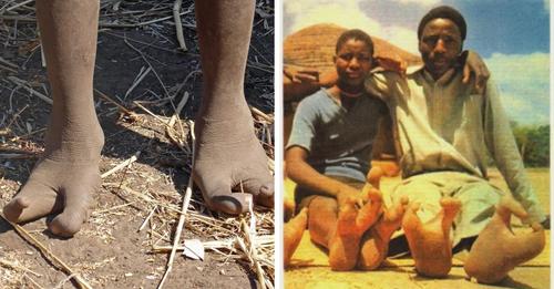 Esta es la tribu con pies de avestruz: los Vadoma.