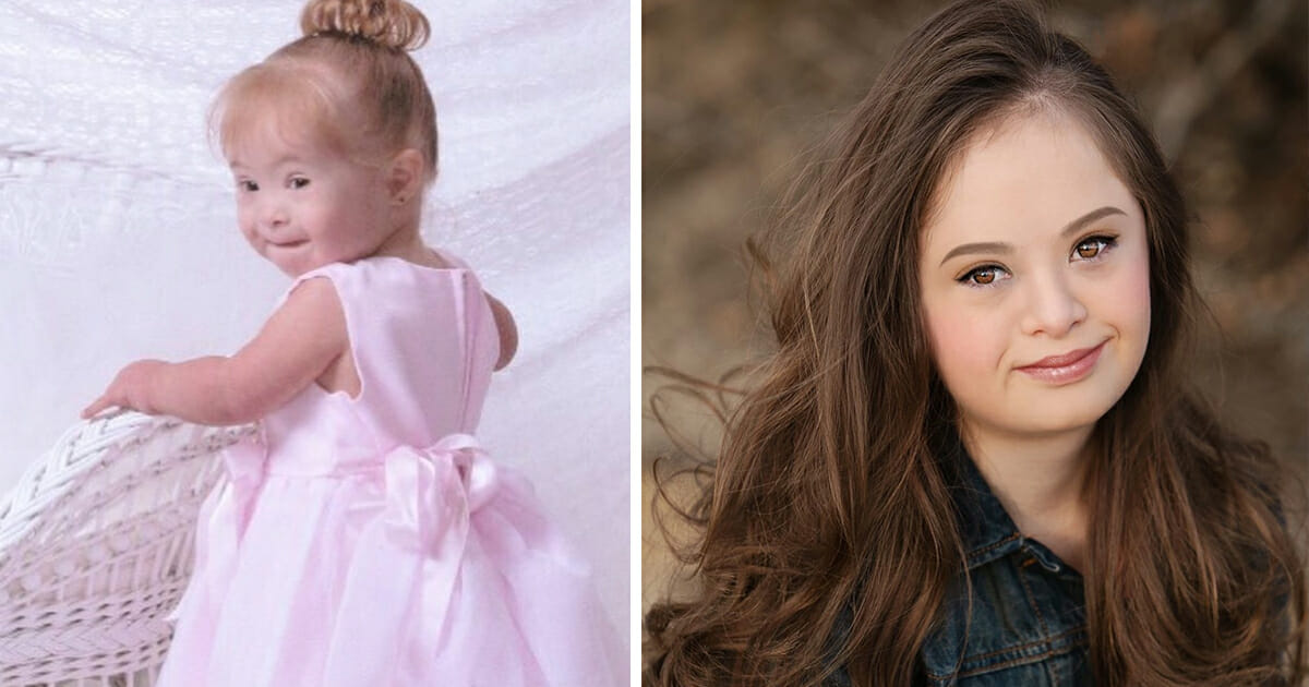Doctors wanted to put girl with Down syndrome in an institution – 15 years later, she’s a top model