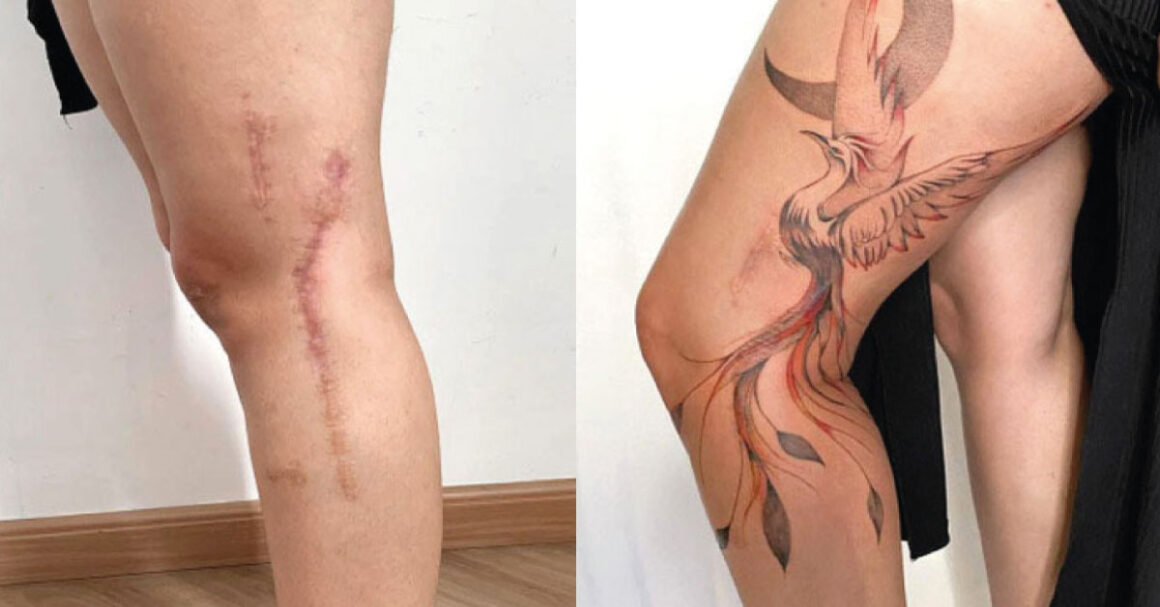 13 cicatrices que se convirtieron en obras de arte a través de tatuajes