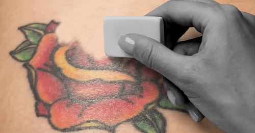Borrar un tatuaje, estos son los pasos seguros que hay que dar